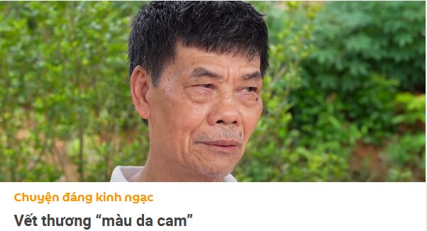 CHIẾN TRANH ĐÃ LÙI XA, NỖI ĐAU CHẤT ĐỘC DA CAM VẪN CÒN ĐÓ: 3 TRIỆU NẠN NHÂN VÀ GIẤC MƠ DANG DỞ CỦA NHỮNG ĐỨA TRẺ 3 CHIẾN TRANH ĐÃ LÙI XA, NỖI ĐAU CHẤT ĐỘC DA CAM VẪN CÒN ĐÓ: 3 TRIỆU NẠN NHÂN VÀ GIẤC MƠ DANG DỞ CỦA NHỮNG ĐỨA TRẺ